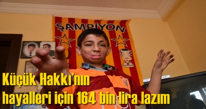 K&uuml;&ccedil;&uuml;k Hakkı&rsquo;nın hayalleri i&ccedil;in 164 bin lira lazım