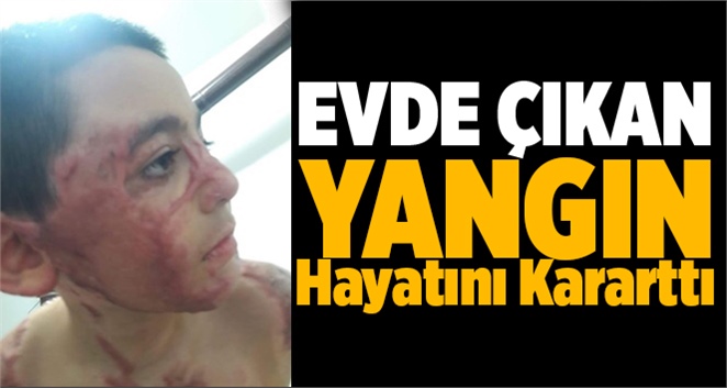 Cumali Umut Eşitmez&rsquo;in Tedavisi İ&ccedil;in 255 Bin Lira Gerekiyor